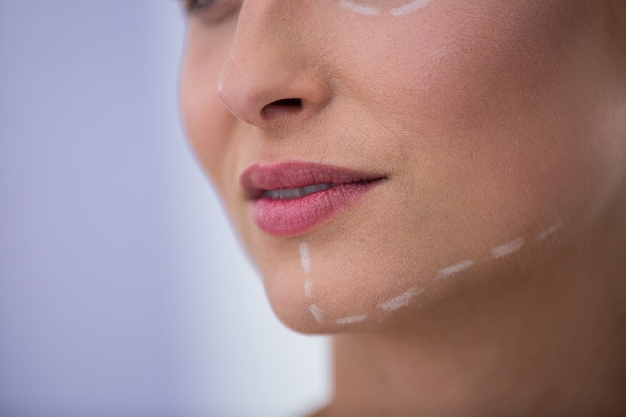 gidi_liposuction_2.jpg